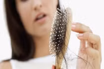 Bác sĩ mách cách thay đổi thói quen, cách ăn uống để tránh rụng tóc
