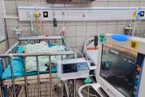 2 lần can thiệp cứu trẻ vừa sinh bị hẹp khít động mạch phổi