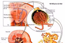 Suy thượng thận do dùng thuốc corticoid chữa dị ứng, viêm khớp