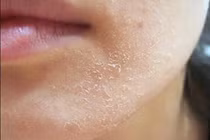 Bí quyết xua tan nỗi ám ảnh khô da trong mùa đông