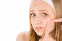 Tips chăm sóc da đúng cách cho tuổi dậy thì