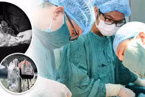 Mổ cấp cứu, bảo tồn tử cung cho sản phụ bị rau cài răng lược