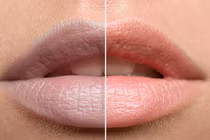 Môi nhợt nhạt thiếu chất gì?
