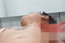 Đang ngồi nhậu cùng bạn, nam thanh niên bị chém trọng thương