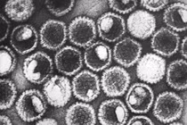 Virus herpes simplex (HSV-1) gây bệnh mụn rộp hoặc zona thần kinh ở người.