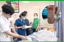 Đắp lá ngải nóng để phục hồi chức năng, người đàn ông bị bỏng độ 3