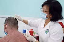 Trị vẩy nến bằng Đông y: Loạn sản phẩm, công dụng