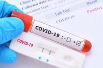 Các loại test nhanh người dân nên chọn khi xét nghiệm COVID-19