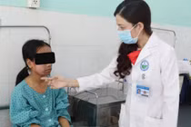 Khuôn mặt thiếu nữ lở loét vì kem lột trắng da