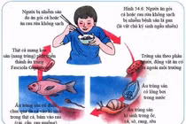 Gan to do sán lá gan nhỏ