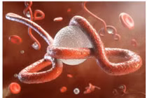 Virus Ebola khiến 25-90% người nhiễm bệnh tử vong trú ẩn trong não chờ kích hoạt lại