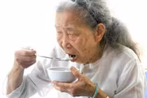 Phục hồi chức năng rối loạn nuốt