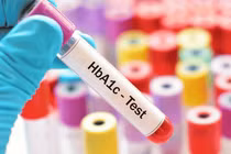 Giá trị của chỉ số HbA1C 