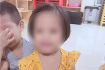 Hà Nội hỏa tốc yêu cầu điều tra vụ bé 3 tuổi bị người tình của mẹ bạo hành