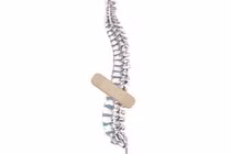 Tránh tổn thương lưng và gãy cột sống trong sinh hoạt