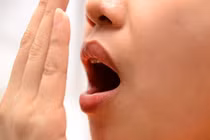 Viêm amidan có gây hôi miệng?
