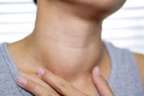 Cổ to ra là dấu hiệu của bệnh gì?