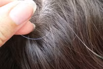 Cách lấy tóc làm xét nghiệm AND