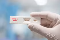 Xử lý sao khi mắc Covid-19 có kết quả dương tính kéo dài