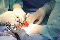 U sùi loét vì đắp thuốc