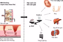Nguy cơ tiền sản giật 