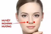 Xoa bóp, châm cứu điều trị viêm mũi dị ứng