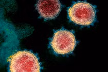 Các nhà khoa học Mỹ đã hoàn thành chế tạo vắc-xin virus corona