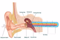 Điếc do tắc vòi nhĩ