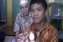 Sự thật bí ẩn gây sốc cậu bé biết đẻ trứng ở Indonesia