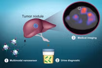 Sử dụng các hạt nano để phát hiện tế bào ung thư 