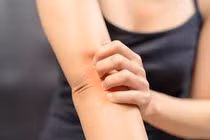 Nguyên nhân ngứa ngoài da