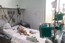 Đồng nhiễm Covid-19 và các bệnh truyền nhiễm khác như sốt xuất huyết thường có các triệu chứng tương tự, có thể chẩn đoán nhầm.