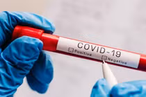 Một người đàn ông Hà Lan bị cáo buộc bán coronavirus 