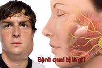 Tưởng người già không bị quai bị