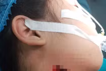 Gia tăng trẻ nghỉ học ở nhà gặp tai nạn