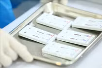 Cơ sở kinh doanh phải niêm yết giá bán test xét nghiệm COVID-19