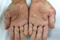 Cẩn thận khi dùng thuốc Đông y có nguồn gốc từ đá, khoáng chất 