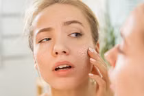 Chống da khô trong mùa lạnh
