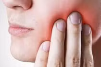 Lưu ý khi nhổ răng khôn