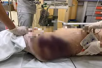 Không đủ quan tâm cũng là một dạng ngược đãi