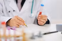  Các xét nghiệm cần làm khi đái máu 