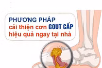 Ảnh minh họa.