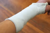 Đứt rễ thần kinh có nối được không?