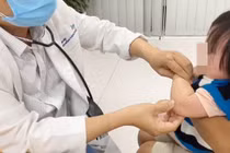 Khuỷu tay non nớt của bé dễ bị trật khi bị kéo mạnh đột ngột