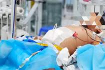 Nguyên nhân khiến nhiều ca sốt xuất huyết trở nặng 