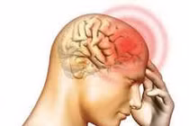 Phát hiện sớm u não