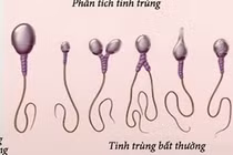 Xông hơi làm yếu "tinh binh"