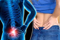 Cảnh báo điều trị đau lưng sai gây áp xe ngoài màng cứng