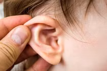Viêm tai giữa lâu ngày nên tầm soát lao tai 