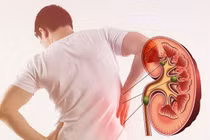 Chế độ ăn cho người suy thận 